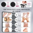 krofaue 1000RPM Electric Callus Remover - Professional Aluminum Foot File Adjustable Pedicure Tool with 60pcs Sandpaper Discs for Dead Skin at Home — 6