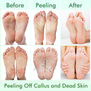 5 Pack Foot Peeling Mask,Exfoliator Peel Off Calluses Dead Skin Callus Remover,Foot Mask for Dry Cracked Feet,Foot Peel Masks for Men and Women,Feet Peeling Mask,Spa Gifts for Women,Self Care Gifts — 3