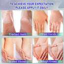 Urea Cream with 2% Salicylic Acid Foot Cream for Dry Cracked Heels, Heel Care Cream 5.29 Oz (Pack of 1) — 5