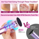 LIONVISON Electric Foot Callus Remover: Adjustable Speed Foot File - Pink — 5