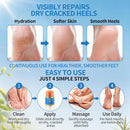 60% Urea Foot Cream Stick with 2% Salicylic Acid - Maximum Strength Callus Remover for Dry Cracked Heels, Hands, Knees - Non-Greasy Solid Shea Butter Heel Balm for Intensive Formula & Easy To Use — 4