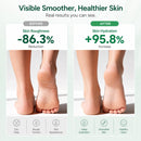 Urea Cream 40 Percent for Feet Maximum Strength,6 OZ Foot Cream for Dry Cracked Heels, Callus Care with 2% Salicylic Acid, Moisturizer for Hands Elbows Knees Rough Skin — 4