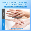 42% Urea Cream for Dry & Cracked Skin - Foot & Hand Cream with 2% Salicylic Acid, 5% Vitamin E, Tea Tree Oil, Aloe Vera, Shea Butter - Moisturizer & Skin Repair Cream for Feet Maximum Strength — 5