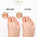Tea Tree Oil Foot Soak with Epsom Salt - Made in USA - for Toenail irritations, Athletes Foot, Stubborn Foot Odor Scent, Softens Calluses & Soothes Sore Tired Feet - 16 Ounce — 6