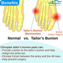 Chiroplax Tailor's Bunion Corrector Pad Bunionette Straightener Separator Cushion Pinky Toe Protector Shield Pain Relief Spacer Splint Cover Guard (Medium, 6 Pack) 4
