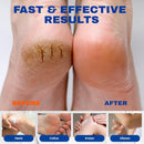 Urea Cream 40 Percent Plus 2% Salicylic Acid for Feet Maximum Strength — 3