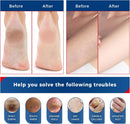 OUKEYA Urea Cream 40 Percent for Feet and Cracked Heels, 5.29 oz - 5.29 Ounce(40% Urea Cream) — 5
