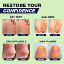 Tea Tree Callus Remover Gel & Foot Soak, Foot Cream for Dry Cracked Feet — 5