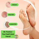 Mr. Pumice Callus Remover Pumi Bar: Pedicure Stone & Foot Scrubber - Medium Grit (4 Pack, Colors), Assorted, (Pack of 4) — 5