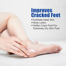 Urea Cream 60% plus 2% Salicylic Acid for Feet Maximum Strength - Lotion For Dry Cracked Feet Elbows Knees Heels Hands, Hydrates Foot Care for Softening and Moisturizing, Callus Remover 10.1oz — 5