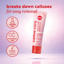 Onyx Professional Callus and Corn Peeling Gel, 4 fl oz - Removes Unwanted Calluses in 3-5 Minutes, Hydrating and Softening Heel Callus Remover Gel for Feet 4