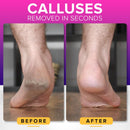 NYK1 RUSTPROOF Foot File Callus Remover for Feet with Catcher | XL Size — 2