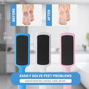 Fu Store Pedicure Foot Files Callus Remover with Double Sided Feet Rasp — 3