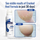 FOOTLOGIX Cracked Heel Formula Mousse 4.23 oz – Foot Care Mousse with Urea, Evening Primrose Oil & Co-Q10 | Dermal Infusion Technology | For Dry, Rough & Callused Feet | Non-Greasy, Unscented — 3
