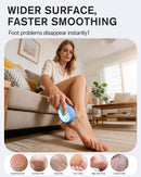 BEZOX Glass Foot File Callus Remover – Professional Foot Scrubber for Dead Skin & Cracked Heels – Premium Pedicure Tools for Feet with Anti-Slip Handle and Protective Cover - Blue — 2