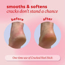 Onyx Professional Cracked Heel Treatment, Repairs Dry Heels, Coconut, 1 pk — 4