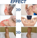 Capsacare Neuropathy Relief Cream for Feet, Hands, Legs, Joints, Waist and Muscles, Neuropathy Cream, Nerve Cream with Capsaicin, Arnica, Menthol (2) — 5