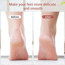 ZABOUL Callus Removers for Feet, Electric Foot Callus Remover Rechargeable with 2 Roller Heads Electronic Foot File Removes Hard Skin for Soft Beautiful Feet, Feet Care Pedicure Tools — 3