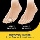 Dr. Scholl's One-Step Wart Remover Bandages, Removes Warts, 14 ct — 3