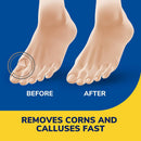 Dr. Scholl's Liquid Corn Remover & Callus Remover, Pain Relief, 0.33 oz — 4