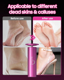 HayZBao FSA&HSA Electric Foot Callus Remover - Callus Remover for Feet,Professional Pedicure Tool for Dead Skin,Electric Foot File with 60 Pcs Sandpaper Discs - Pink — 6