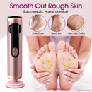 Upgraded Electric Foot Callus Remover - Rose Pink — 6