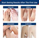 OUKEYA 42% Urea Cream, Foot & Hand Cream for Dry Cracked Rough 3 Oz Tube — 5