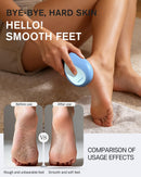 BEZOX Glass Foot File Callus Remover – Professional Foot Scrubber for Dead Skin & Cracked Heels – Premium Pedicure Tools for Feet with Anti-Slip Handle and Protective Cover - Blue — 3