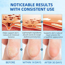 60% Urea Foot Cream Stick with 2% Salicylic Acid — 5