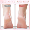 Electric Foot File and Callus Remover,Professional Pedicure Tools for Dry, Calluses, Dead, Cracked, Hard Skin,Equipped with 2 Grinding Heads and 1 Cleaning Brush — 3