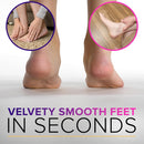 NYK1 RUSTPROOF Foot File Callus Remover for Feet with Catcher | XL Size — 8