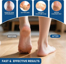 Urea Cream 40 Percent with 2% Salicylic Acid, Urea Cream 40 Percent for Feet Maximum Strength, Foot & Hand Cream for Dry Cracked Heels, Callus Softener for Rough Thick Skin, 5.29 oz - 1P — 4
