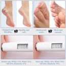 10.1 Oz - Urea Cream 70% plus Salicylic Acid 2% for Dry Cracked Feet, Heels, Knees, Elbows and Hands, Moisturizes, Softens and Removes Calluses Dead Skin - Dark Blue — 6