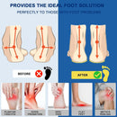 Plantar Fasciitis Insoles, High Arch Support Shoe Inserts for Women Men — 3