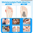 2 Pairs Metatarsal Pads, Soft Ball-of-Foot Cushions for Comfort 4