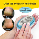 PedEgg Foot File, Painless Callus Remover, Mess-Free, As Seen on TV — 3