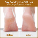 Nano Glass Foot File, Double-Sided Foot Callus Remover for Cracked Heels - Black — 6