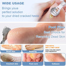 36 Pcs Callus Shaver for Feet Set, Foot Callus Shaver, (1 Stainless Foot File &1 Foot File Heads & 4 Pedicure Knife & 30 Replacement Slices Blades) — 4