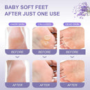 Foot Peeling Mask (5 Pack) Exfoliant for Peeling Off Calluses, Natural Exfoliator for Dry Dead Skin, Callus, Repair Rough Heels Soft Smooth Touch — 4