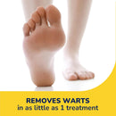 Dr. Scholl's Freeze Away Wart Remover for Hands & Feet, 12 ct – Removes Fast in as Little as 1 Treatment, Fast-Acting Treatment for Common and Plantar Wart Removal, Safe to Use on Kids Ages 4+ — 3