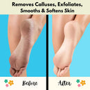 Mr. Pumice Callus Remover Pumi Bar: Pedicure Stone & Foot Scrubber - Medium Grit (4 Pack, Colors), Assorted, (Pack of 4) — 2