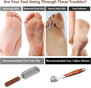 2 Pack Pedicure Kit, Foot File Callus Remover, Heel Scraper for Feet — 5