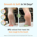 ZenToes Urea Foot Cream 40% for Cracked Heels & Dry Feet, 5 oz — 2