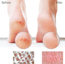 Glass Foot File Callus Remover for Feet, Heel Scraper, Pumice Stone, Diabetic Feet Scrubber Dead Skin Remover for Feet Professional Pedicure Tools - Coarse-pro — 3