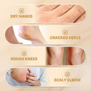 60% Urea Cream for Feet with 2% Salicylic Acid for Deep Hydration-150g — 6
