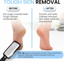 Colossal Foot rasp Foot File and Callus Remover. Best Foot Care Pedicure Metal Surface Tool to Remove Hard Skin. Can be Used on Both Wet and Dry feet, High Grade Stainless Steel File — 2