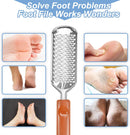 Professional Foot Scrubber Dead Skin Remover, Pedicure Foot File Callus Removal, Heel Scraper for Cracked Heels, Microplane Cheese Grater for Feet, Foot Rasp for Hard Skin(T1) — 3