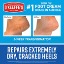 OKeeffes for Healthy Feet Heel Repair Kit, 1 Pair Reusable Sleeves — 6