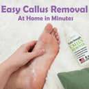 Callus Remover for Feet (Extra Strength 8 oz) Foot Callus Remover Gel — 5