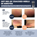 Own Harmony Electric Foot Callus Remover - Rechargeable Pedicure File Tool - Gray — 2